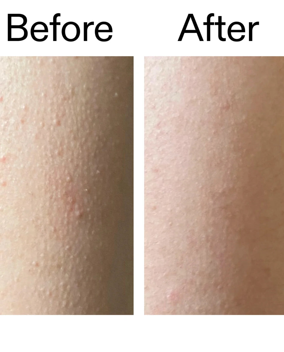 Stick Corps Exfoliant Anti-rougeurs